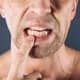 5 عادات ضارة للأسنان واللثة