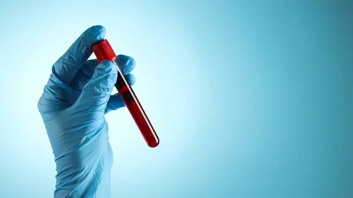 فحص دم يتنبأ بالزهايمر قبل سنوات من ظهور أعراضه