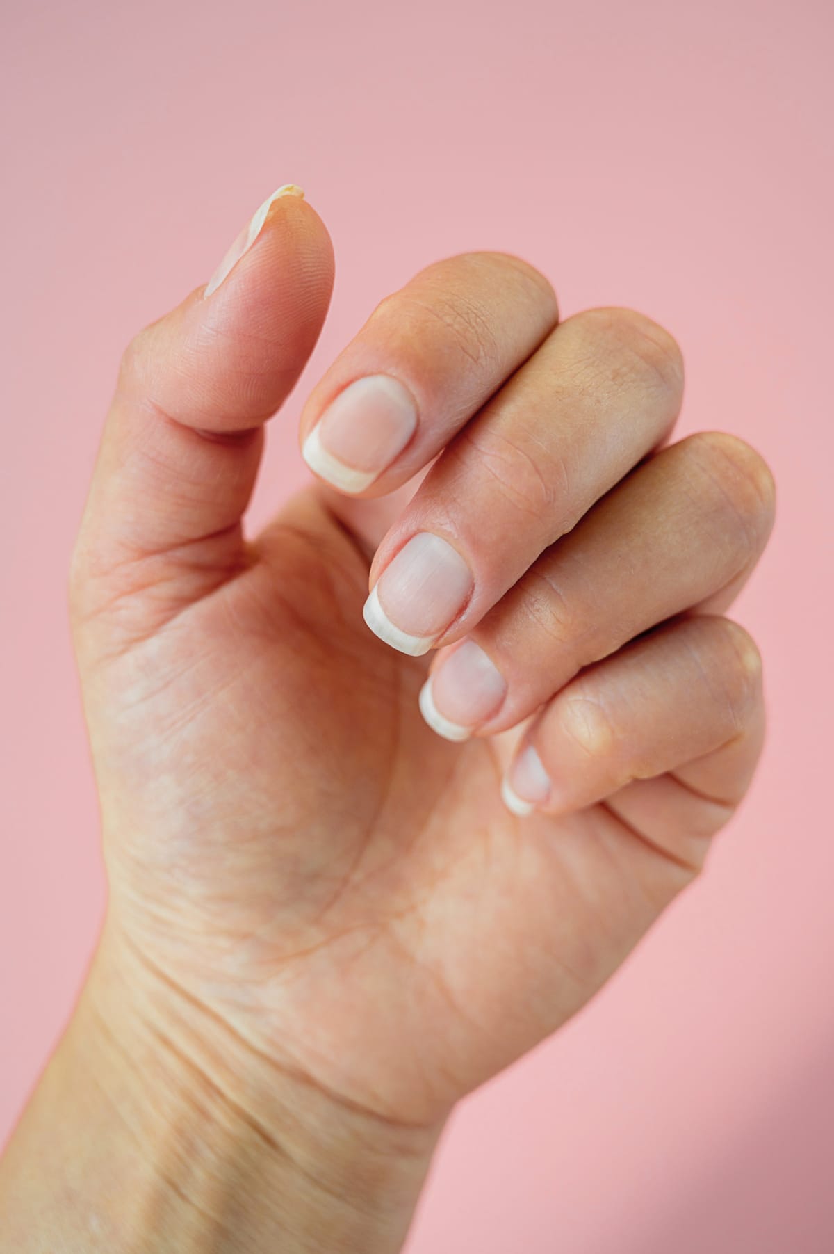 7 home remedies for yellow nails that really work! | TheHealthSite.com