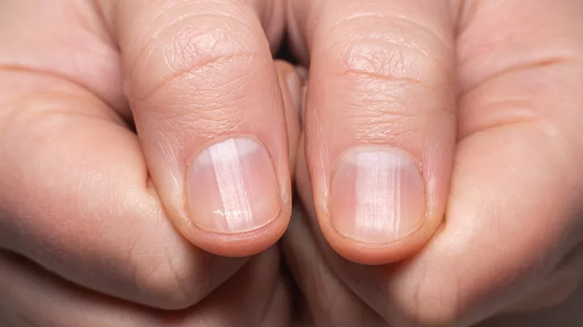 What Those Ridges On Your Fingernails Really Mean What Those Ridges On Your Fingernails Really Mean