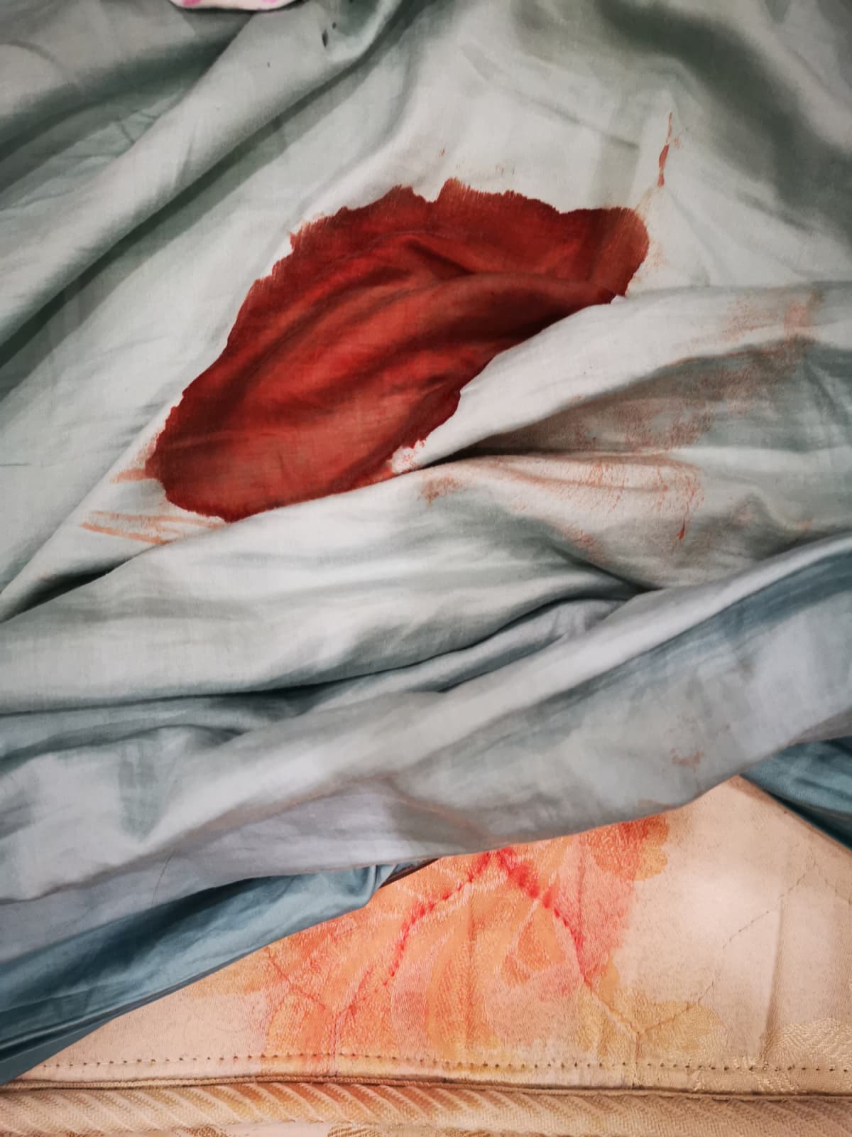 Blood stains on sheet and mattress