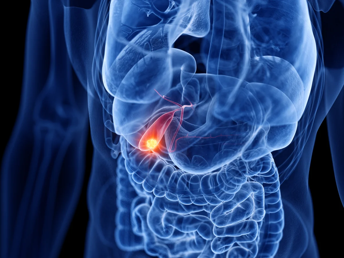 Gallbladder Disease Gallbladder Disease