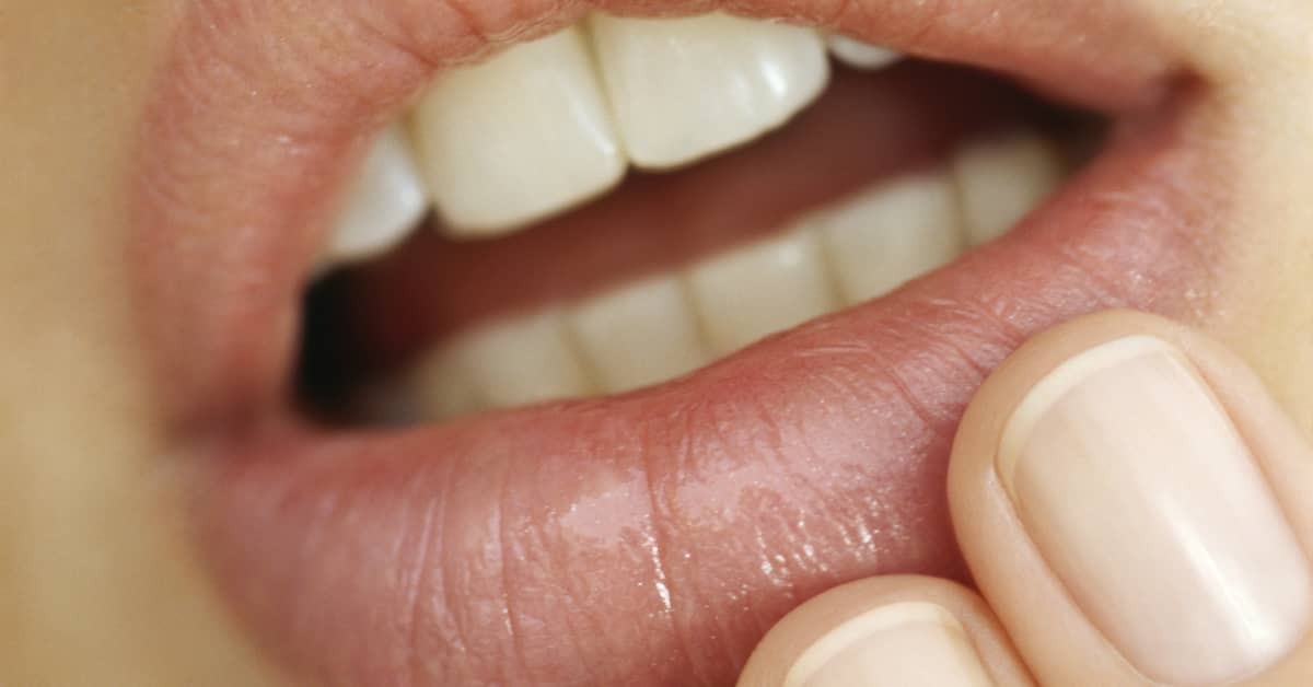 How To Hide A Cold Sore Using Makeup